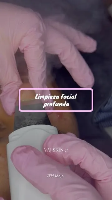 Limpieza facial profunda en proceso