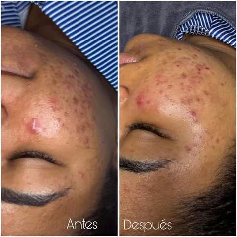 Comparación fotográfica publicada por Vaj Skin